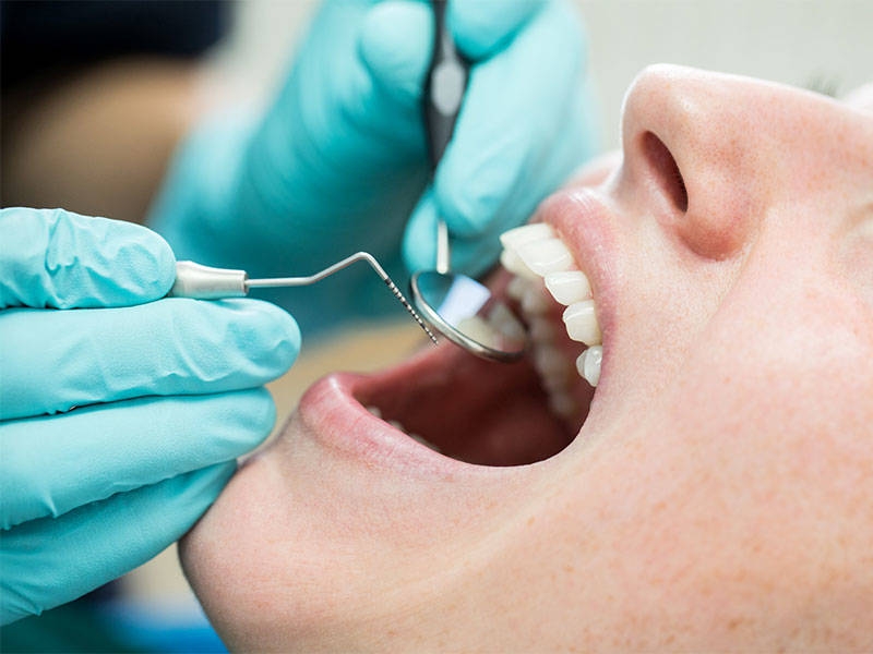 Dentist holding angled mirror and hook while examining patient.